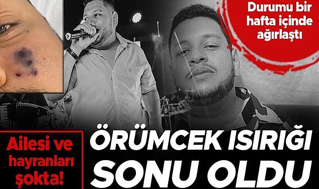 Hayranları ve Sevenleri Şoke Oldu! Örümcek Isırığı Şarkıcı Darlyn Morais'in Ölümüne Sebep Oldu!
